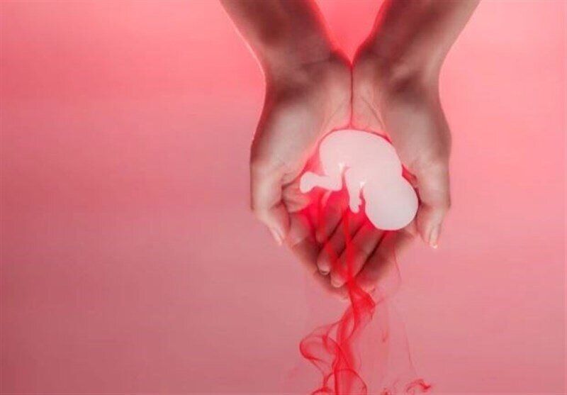 آسیب به جفت عامل مرده‌زایی در زنان مبتلا به کووید-۱۹
