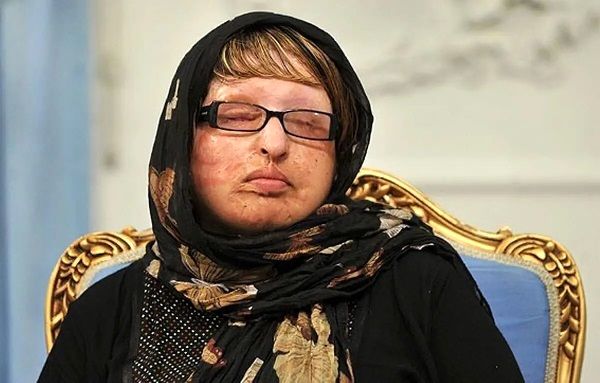آمنه بهرامی؛ همچنان در تلاش برای دریافت دیه چشمانش