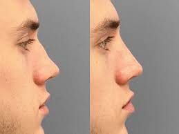 ارزیابی شرایط روحی فرد از طریق مدل بینی‌ ممکن شد