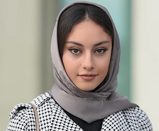 تصویری شوکه کننده از تغییر چهره ترلان پروانه بازیگر سریال هوش سیاه + عکس