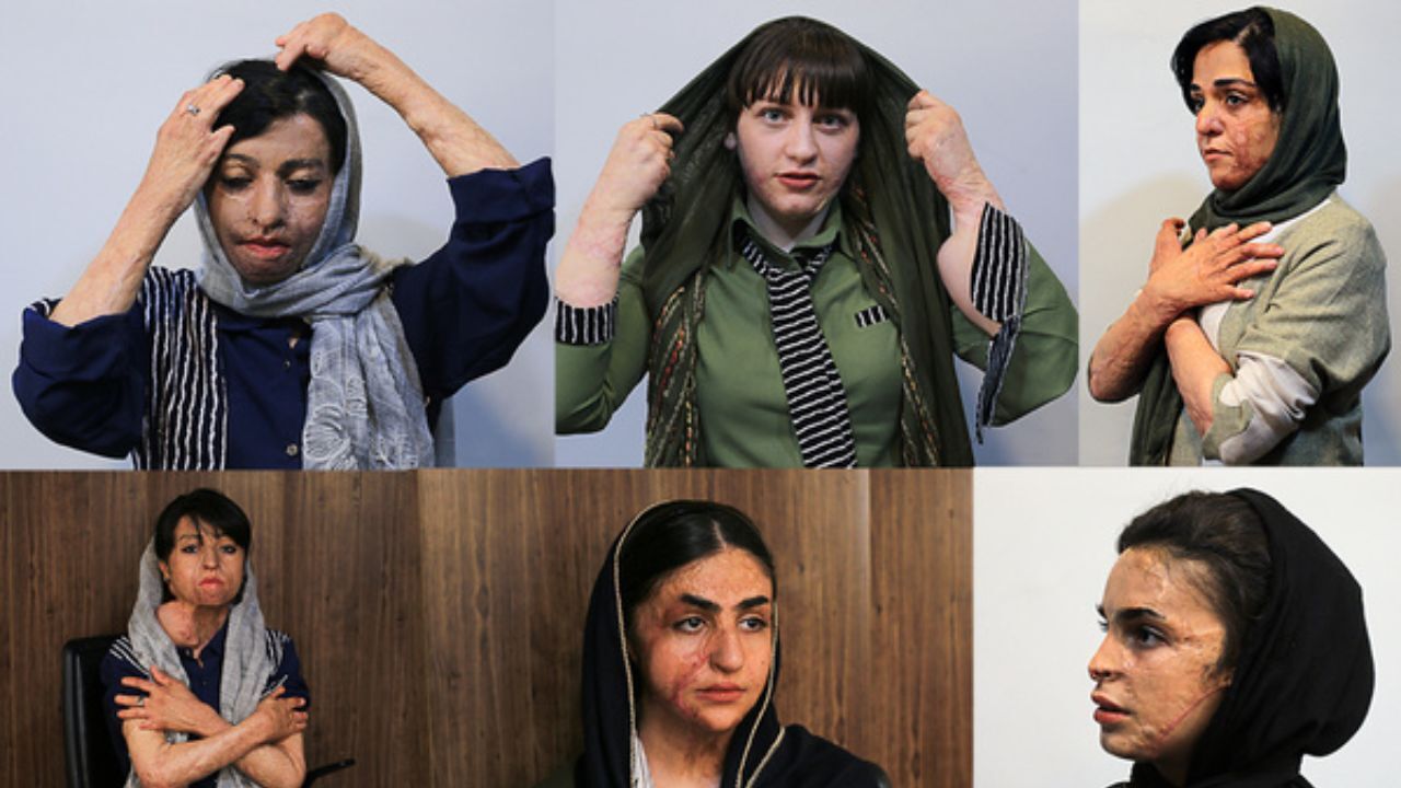دختران شین‌آبادی طی 5 سال، 183 بار جراحی شدند