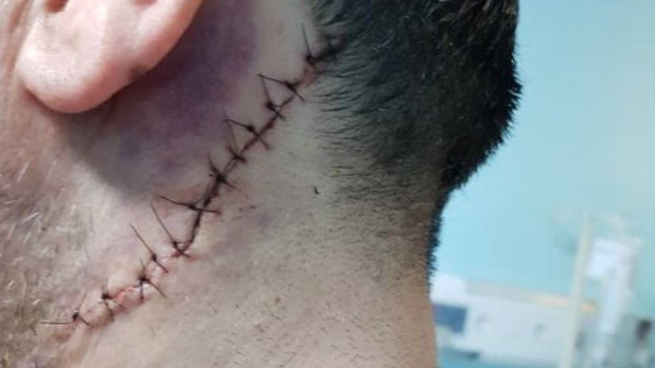 جزئیات دستگیری ضارب سوءقصد به پزشک نجف‌آبادی