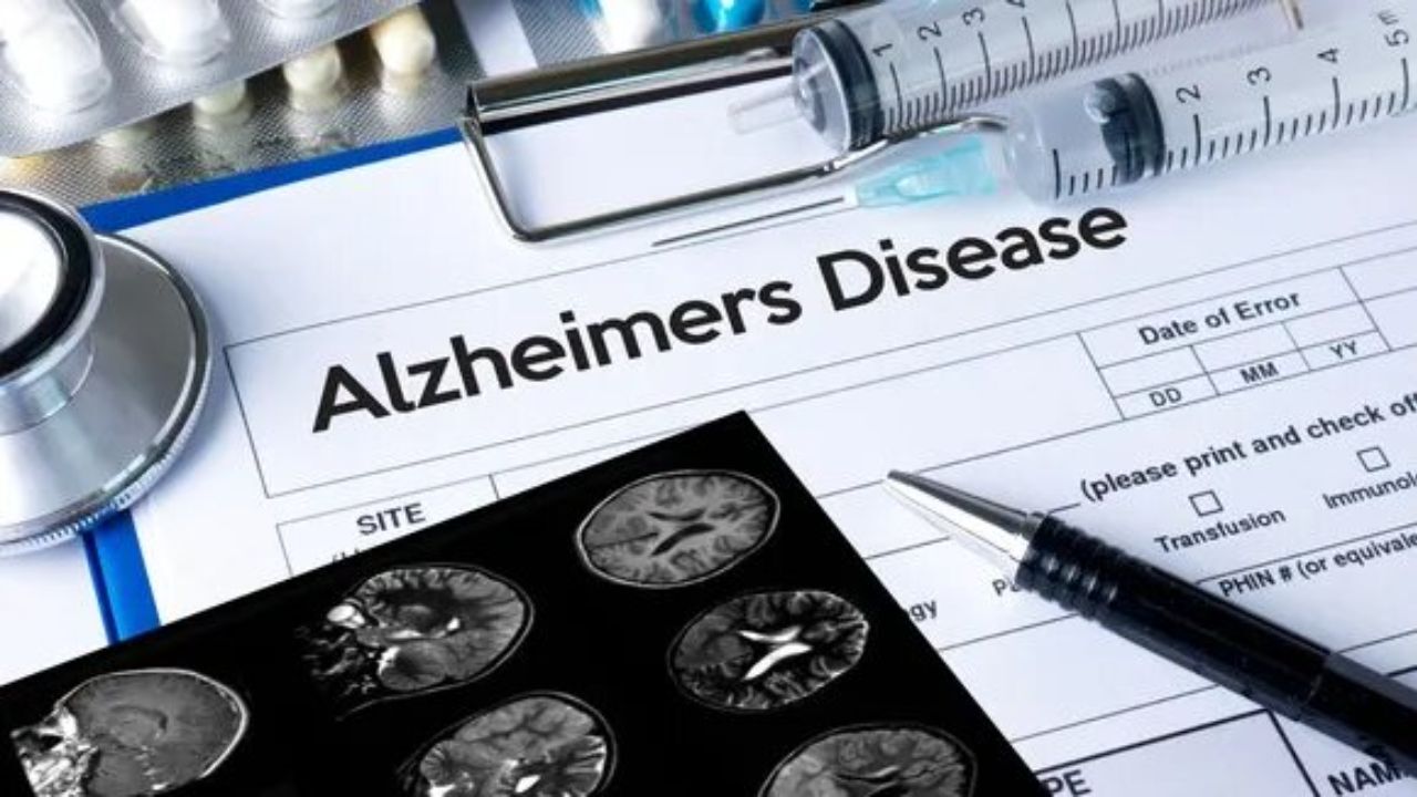 آزمایش بالینی واکسن استنشاقی آلزایمر آغاز شد