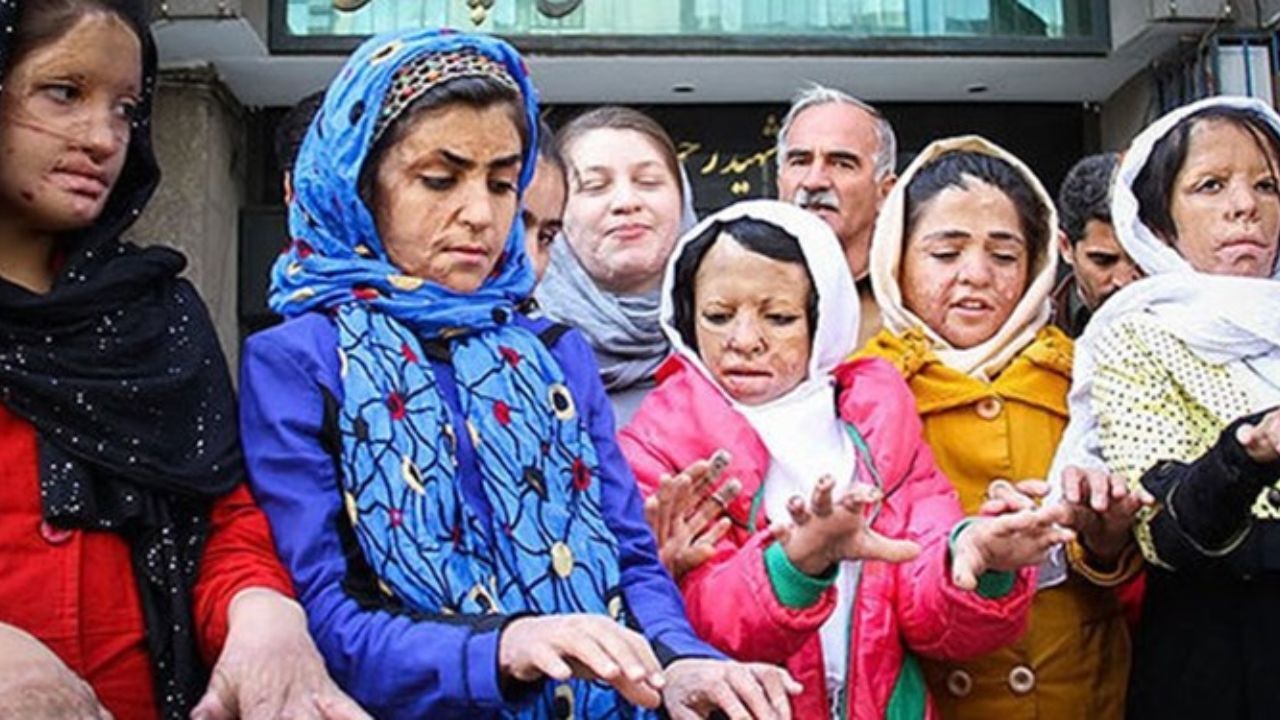 دختران شین آبادی رایگان درمان می‌شوند