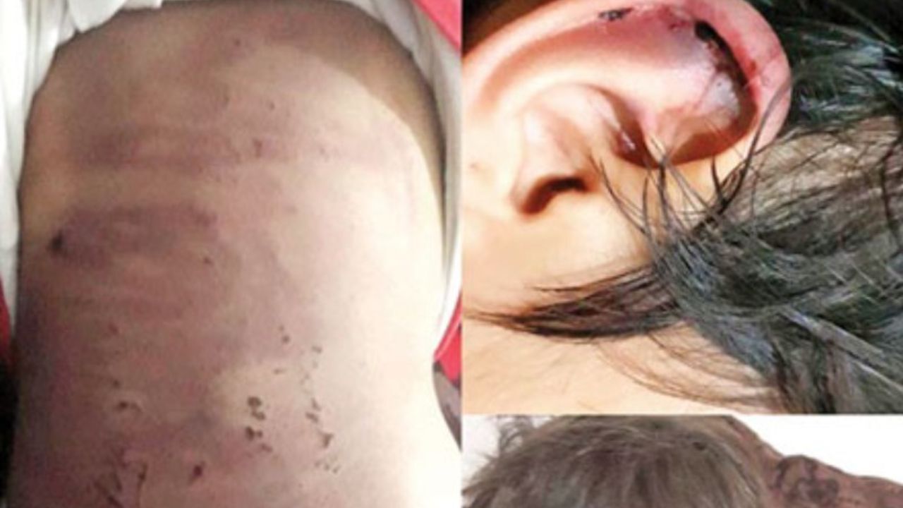 حمایت روانی برای ستایش 5 ساله