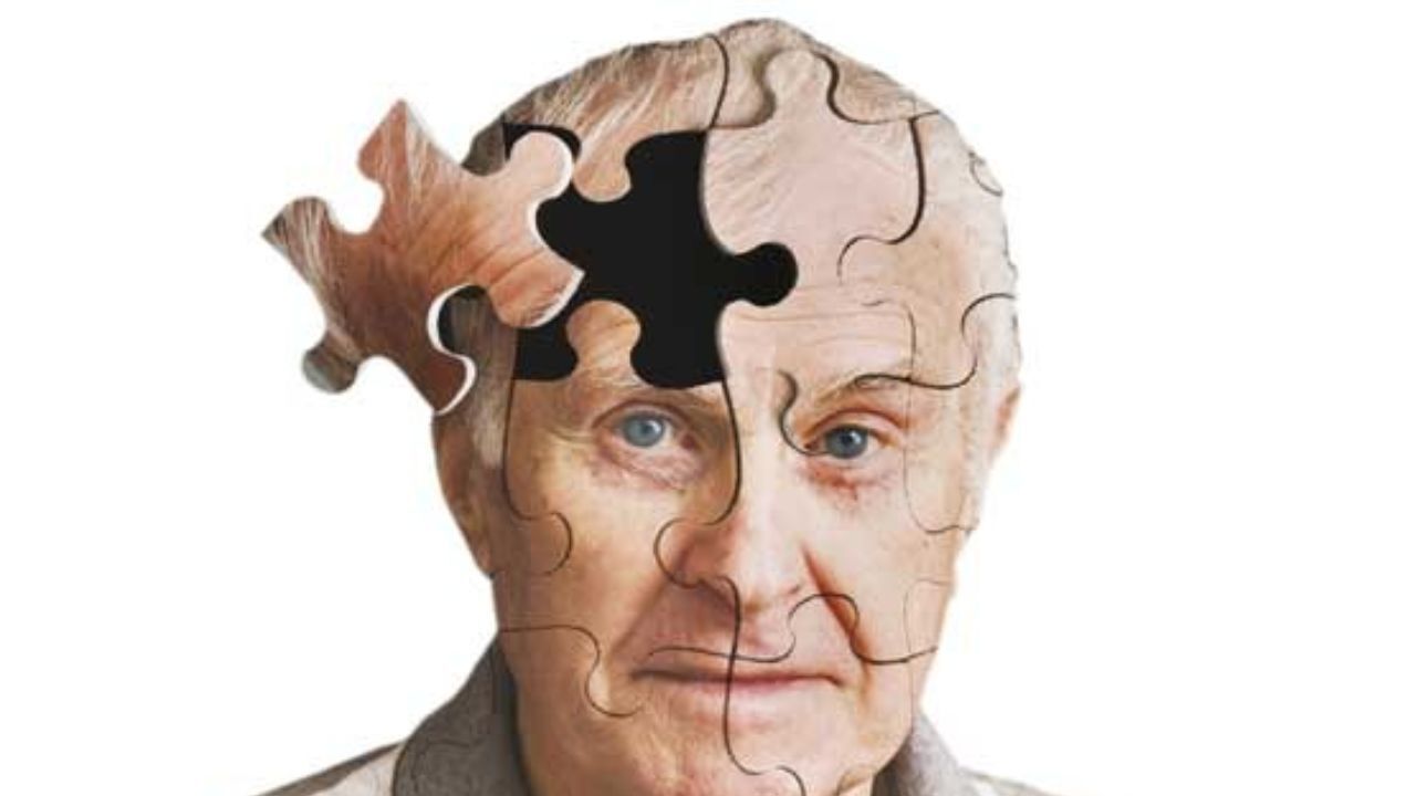 جراحی کاهش وزن ریسک ابتلا به آلزایمر را کاهش می‌دهد