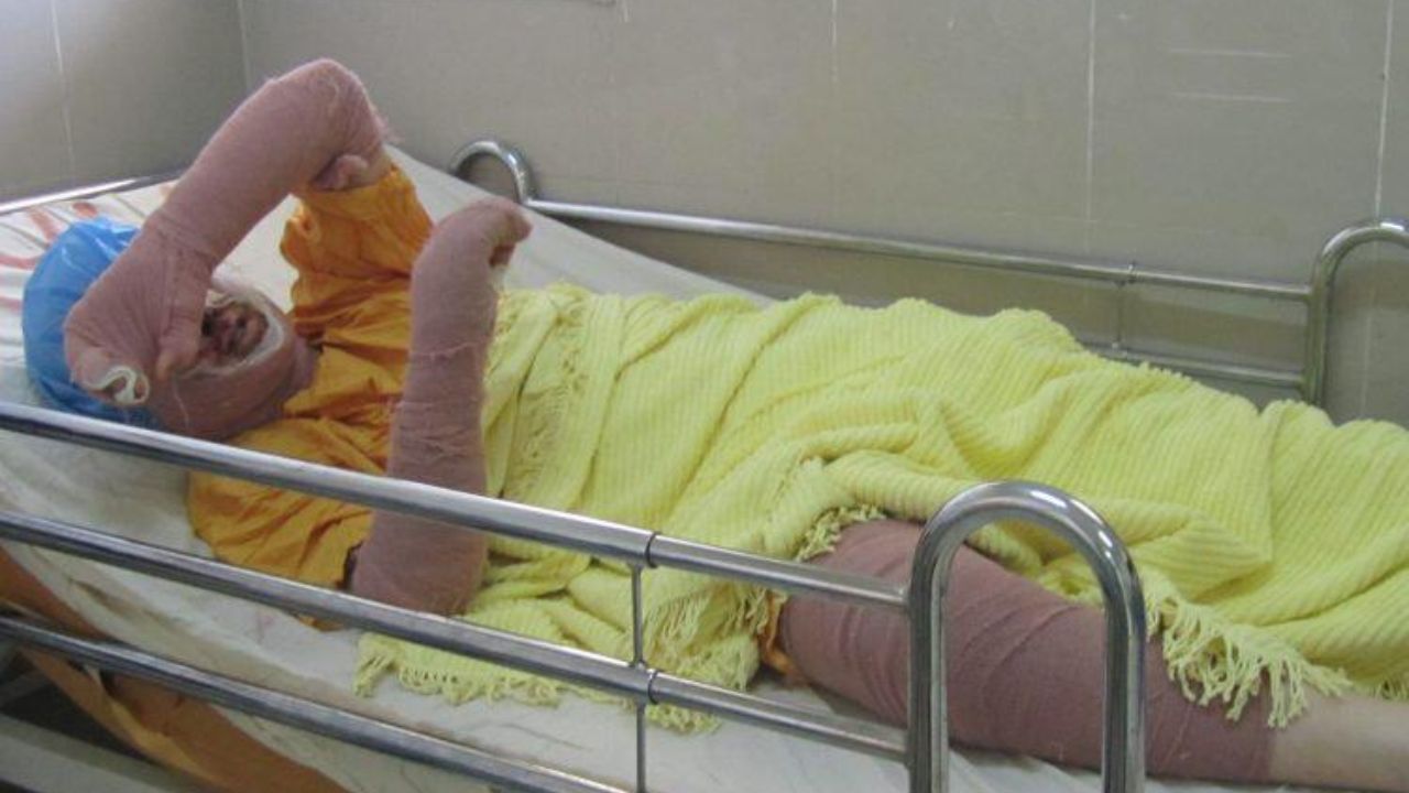 «دختر آبی» درگذشت