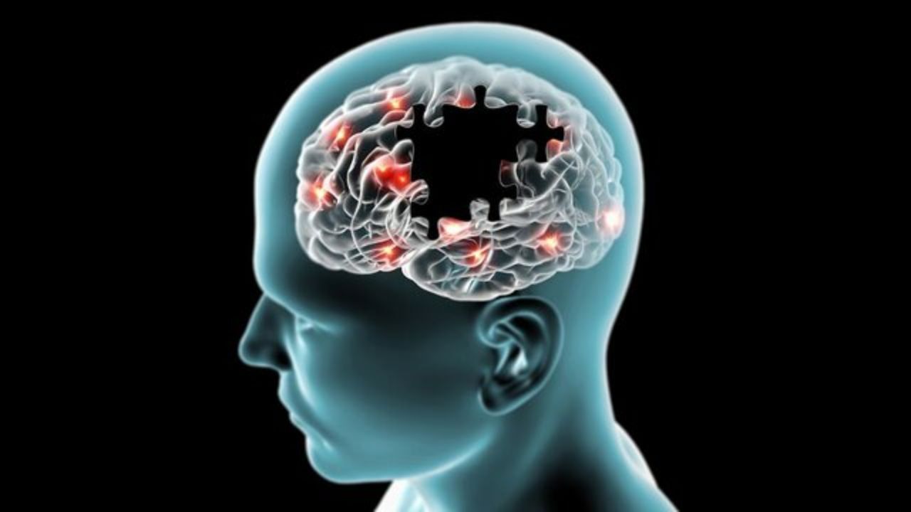 چرا فراموشکار می‌شویم؟