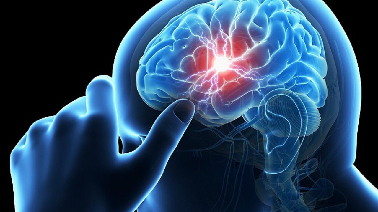 روش درمان و کاهش دردهای ناشی از سکته‌های مغزی