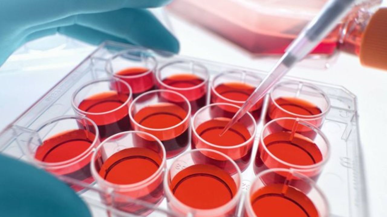 طرحی برای درمان سرطان به کمک سلول‌های خون بند ناف