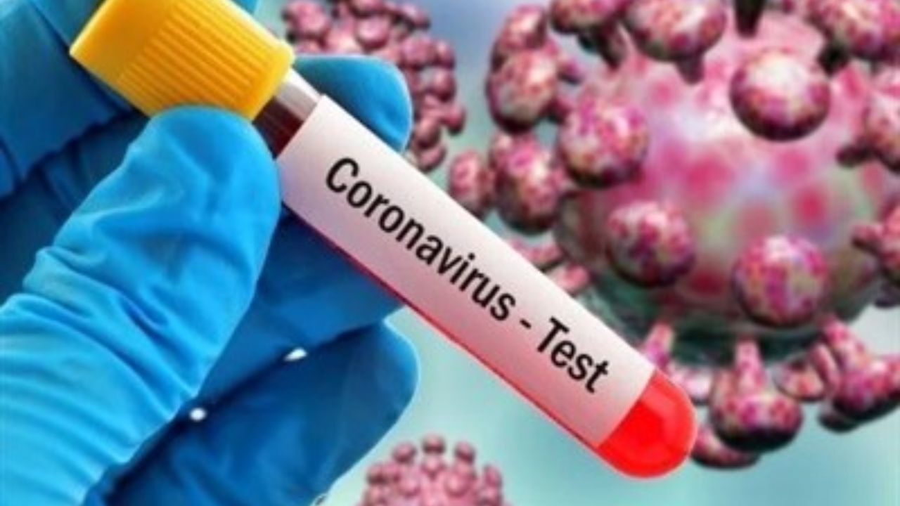 «بولیوی» و «جامائیکا» هم کرونایی شدند