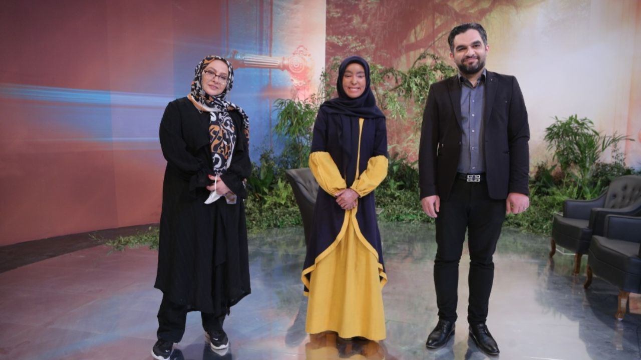 قصه دختر بازیگری که پدر و مادرش به خاطر بیماری پوستی رهایش کردند