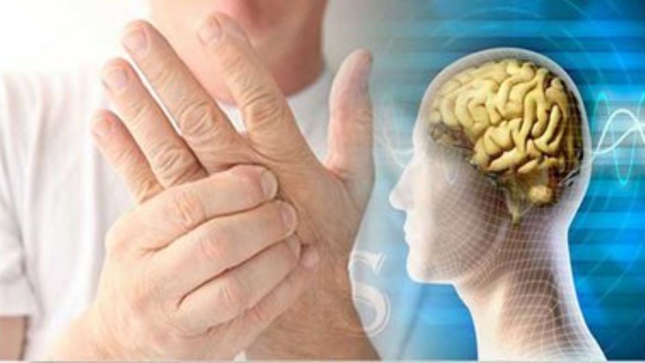 وجود 70 هزار مبتلا به ام‌اس در ایران/ افزایش شیوع بیماری در مناطق شهری کشور